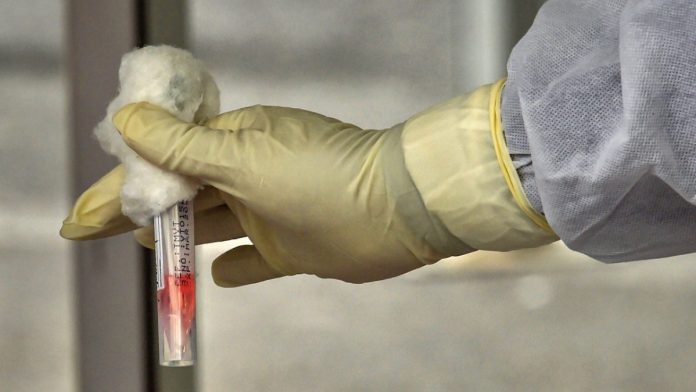 Test_coronavirus_covid A medic works on Covid-19 samples (representational image) | Photo: PTI
